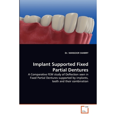 按需印刷不退不换Implant Supported Fixed Partial Dentures[9783639356496]