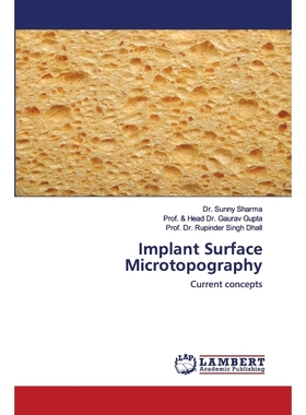 按需印刷Implant Surface Microtopography[9786202557177]