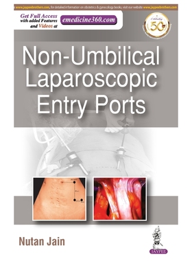 按需印刷NON-UMBILICAL LAPAROSCOPIC ENTRY PORTS[9789389776454]