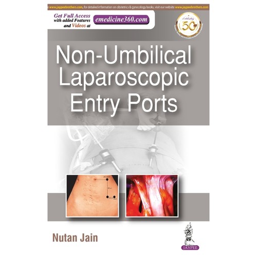 预订，预计下单后2-3周左右发货！