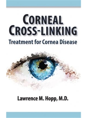 预订Corneal Cross-Linking:Treatment for Cornea Disease