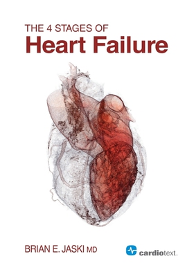 按需印刷The 4 Stages of Heart Failure[9781935395300]