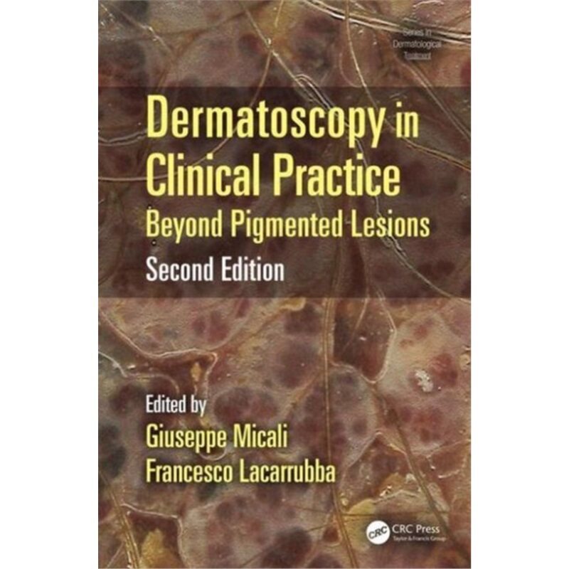预订不退不换Dermatoscopy in Clinical Practice[9781482225952]