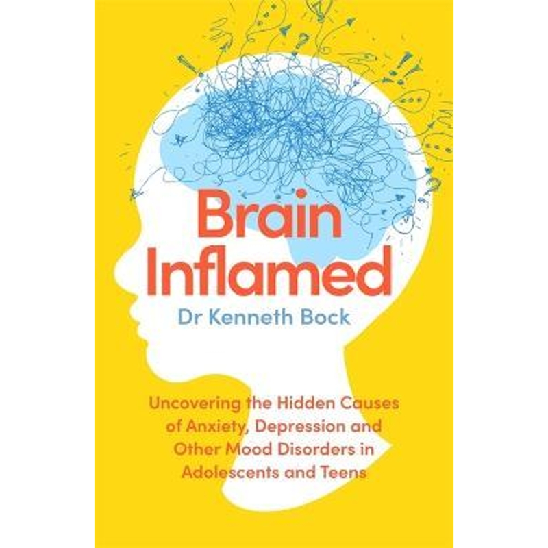 预订，预计下单后2-3周左右发货！