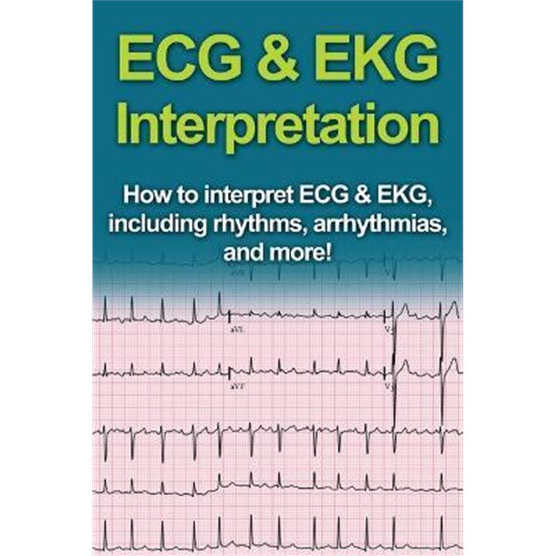 预订不退不换ECG & EKG Interpretation:How to interpret ECG & EKG, including rhythms, arrhythmias, and more!