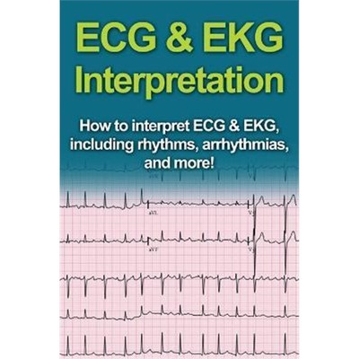 预订ECG & EKG Interpretation:How to interpret ECG & EKG, including rhythms, arrhythmias, and more!