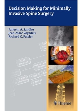 预订Decision Making for Minimally Invasive Spine Surgery[9781604062663]