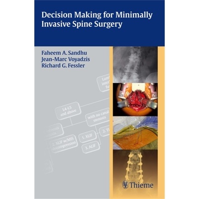 预订Decision Making for Minimally Invasive Spine Surgery[9781604062663]