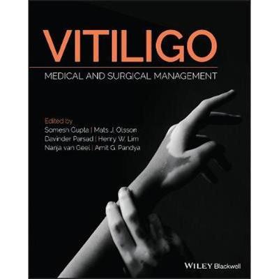 按需印刷Vitiligo:Medical and Surgical Management[9781118937419]