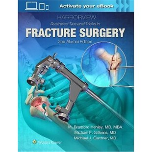 and Tips Illustrated Surgery Fracture Tricks 预订不退不换Harborview