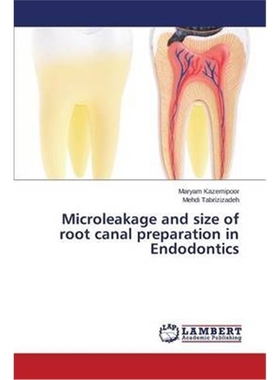 按需印刷图书Microleakage and Size of Root Canal Preparation in Endodontics[9783659504082]