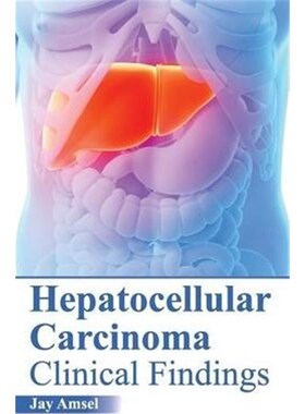 按需印刷不退不换Hepatocellular Carcinoma[9781632422286]