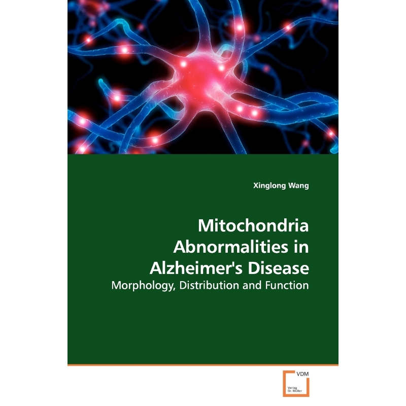 预订，预计下单后2-3周左右发货！