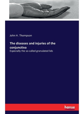 按需印刷The diseases and injuries of the conjunctiva[9783742805638]