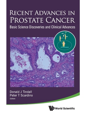 按需印刷不退不换Recent Advances in Prostate Cancer[9789814329453]