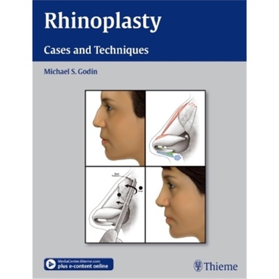 预订【德语】 Rhinoplasty - Cases and Techniques[9781604066807]