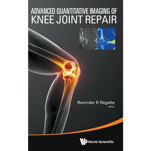 预订，预计下单后2-3周左右发货！