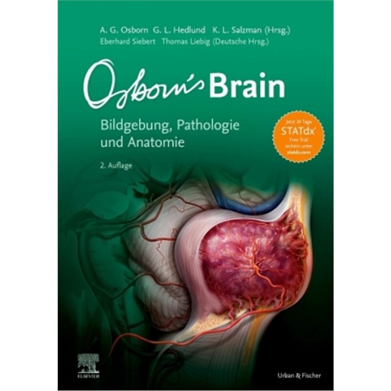 预订，预计下单后8-12周左右发货