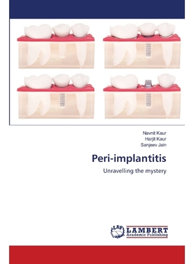 按需印刷Peri-implantitis[9783659744341]