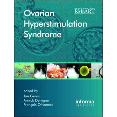 预订Ovarian Hyperstimulation Syndrome[9781842143285]