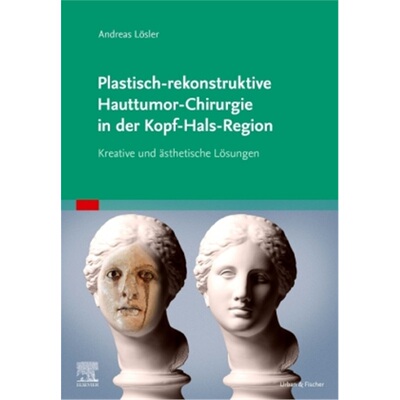 预订不退不换德语Plastisch-rekonstruktive Hauttumor-Chirurgie in der Kopf-Hals-Region[9783437212345]