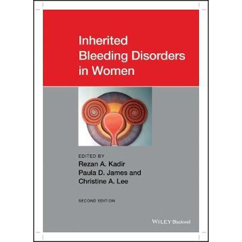 按需印刷Inherited Bleeding Disorders in Women[9781119426028]