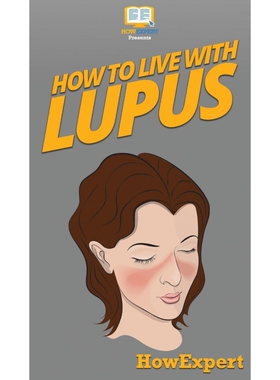按需印刷How To Live With Lupus[9781647585501]