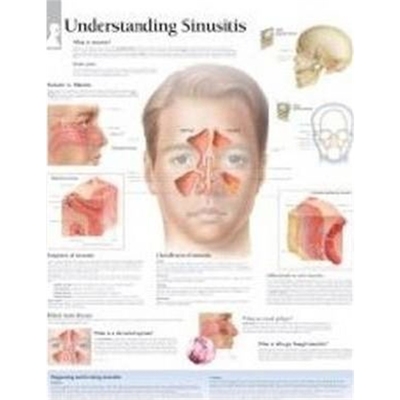 预订Understanding Sinusitis Paper Poster