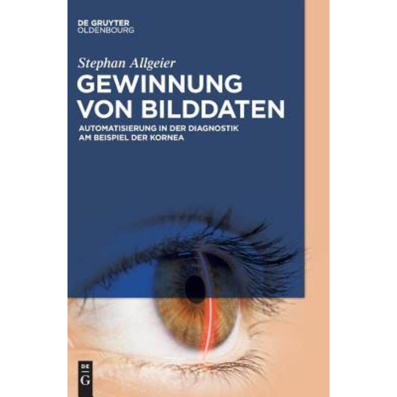 预订不退不换德语 Gewinnung von Bilddaten:Automatisierung in der Diagnostik am Beispiel der Kornea