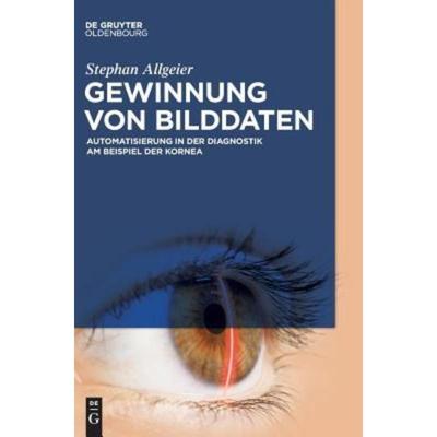 预订【德语】 Gewinnung von Bilddaten:Automatisierung in der Diagnostik am Beispiel der Kornea