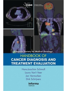 预订ESMO Handbook of Cancer Diagnosis and Treatment Evaluation[9780415390866]