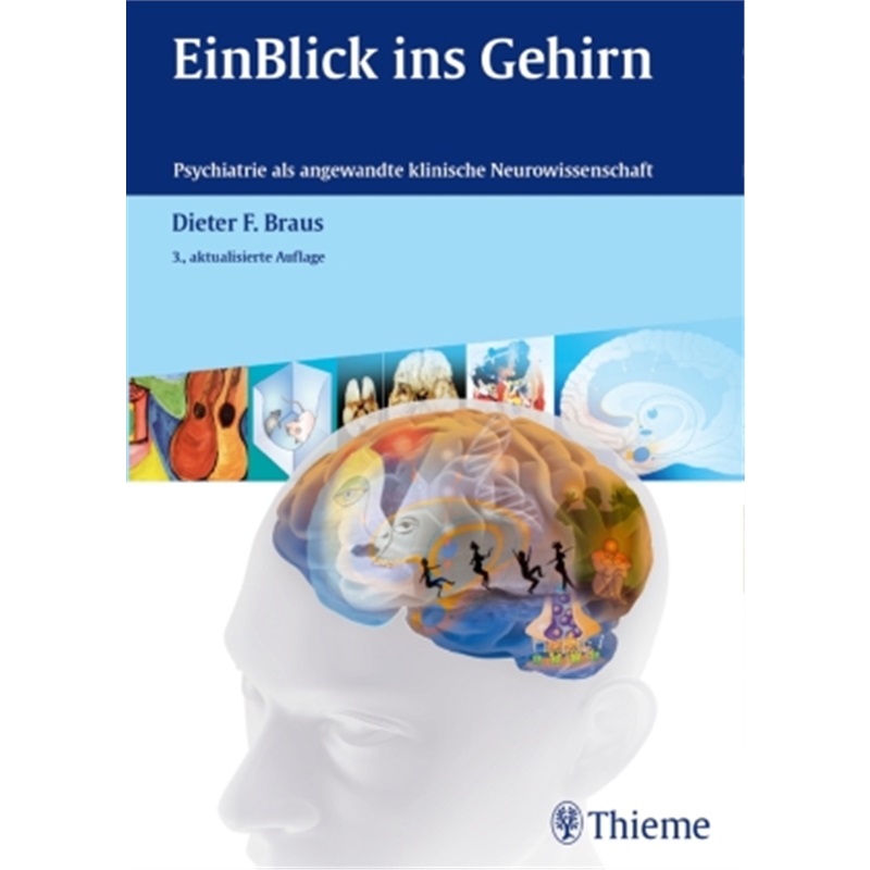 预订，预计下单后8-10周左右发货