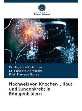 预订【德语】 Nachweis von Knochen-, Haut- und Lungenkrebs in Röntgenbildern: