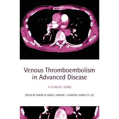 按需印刷Venous Thromboembolism in Advanced Disease:A clinical guide[9780199232048]