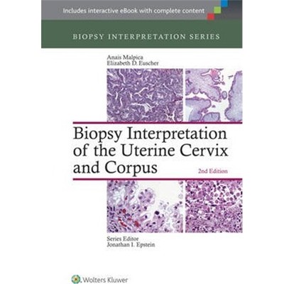 预订Biopsy Interpretation of the Uterine Cervix and Corpus