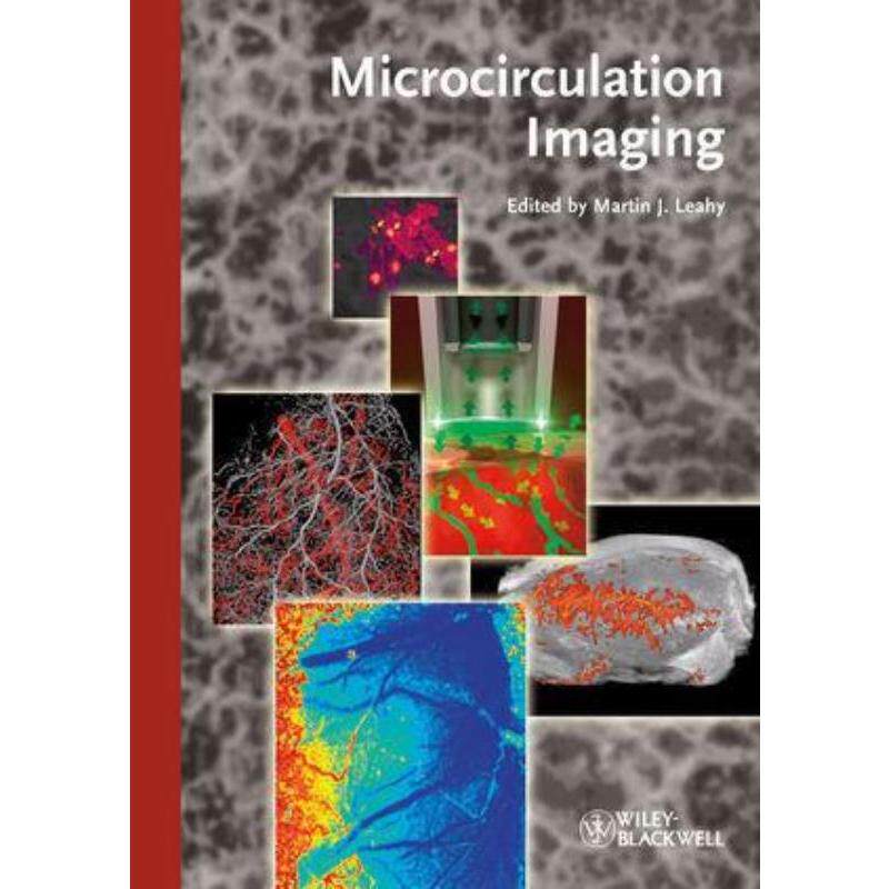 预订不退不换Microcirculation Imaging