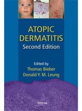 预订Atopic Dermatitis[9781420077988]