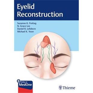 预订不退不换Eyelid Reconstruction