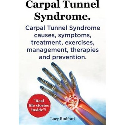 预订Carpal Tunnel Syndrome, Cts. Carpal Tunnel Syndrome Cts Causes, Symptoms, Treatment, Exercises, Management, Therapie