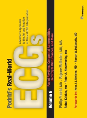 按需印刷Podrid's Real-World ECGs[9781935395065]