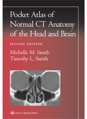 预订不退不换Pocket Atlas of Normal CT Anatomy of the Head and Brain