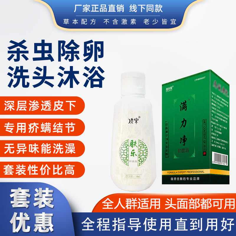 疥疮膏能洗澡疥螨虫止痒沐浴液私处结节满力净庎虱康宁虱疥一扫光