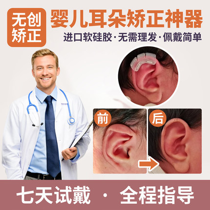 婴儿耳朵矫正器新生儿宝宝耳廓纠正器软硅胶固定神器垂耳畸形耳夹