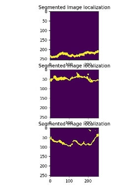 DL00236-基于Unet++的道路裂痕检测方法python代码含数据集