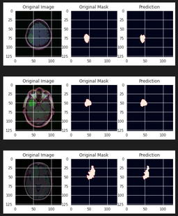 DL00339-基于deeplabv3的脑肿瘤MRI图像语义分割完整实现jupyter
