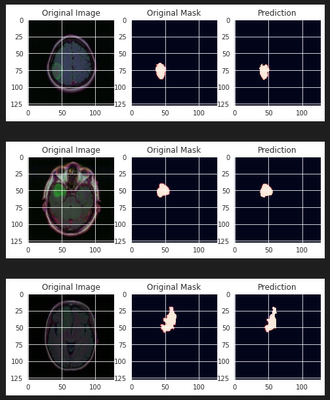 DL00339-基于deeplabv3的脑肿瘤MRI图像语义分割完整实现jupyter