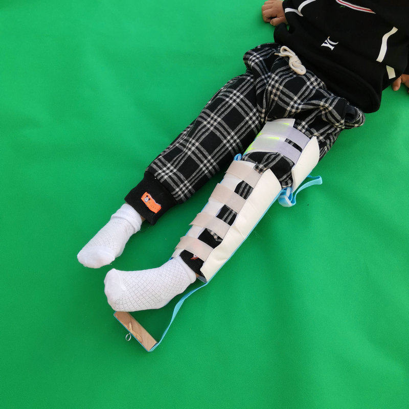 包邮儿童腿部牵引带股骨积液骨折下肢膝盖拉伸大腿小腿髋关节牵引,个人护理/保健/按摩器材,保健护具(护腰/膝/腿/颈),淘宝优惠券,粉丝福利购,淘宝优惠卷