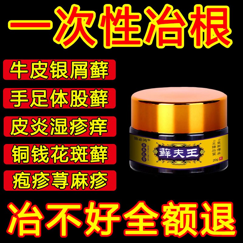 治疗牛皮癣鲜银屑病股藓手足头皮癣水泡湿疹止痒抑菌皮肤专用药膏