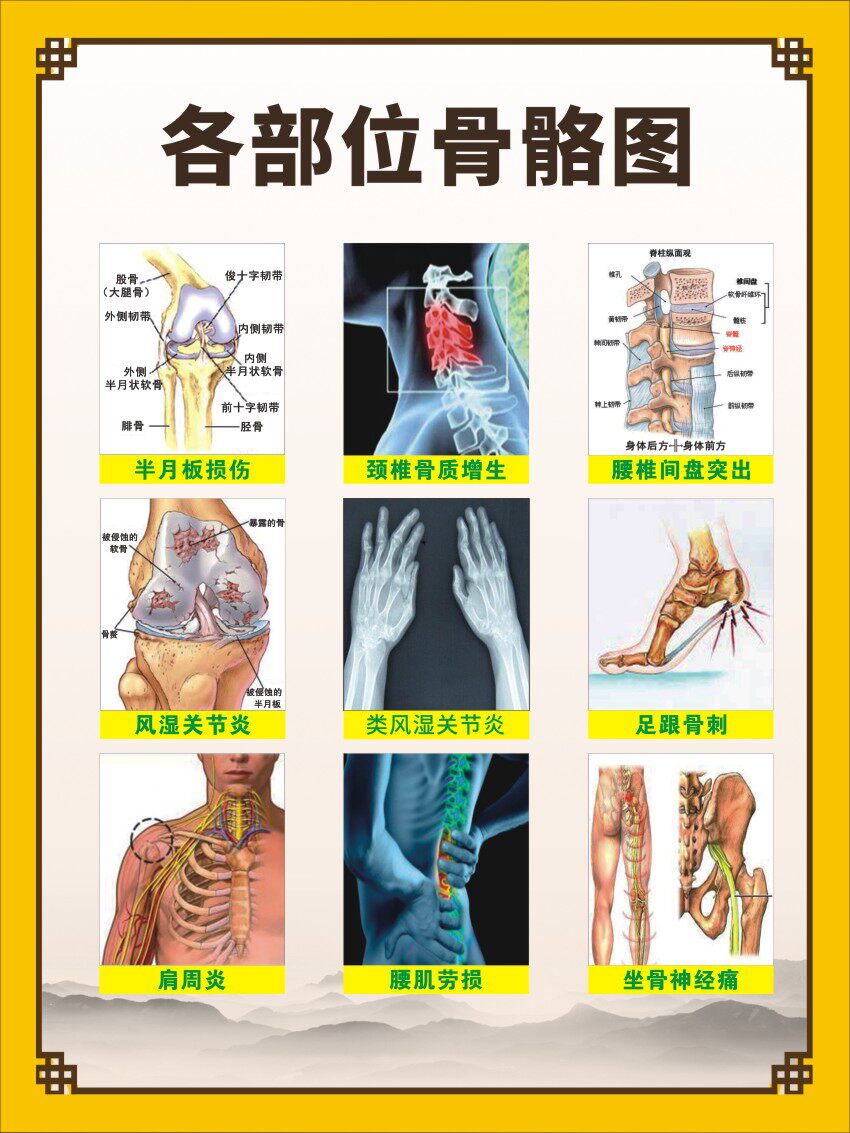 m769人体各部位骨骼图关节肩周示意结构图848海报定印制展板写真