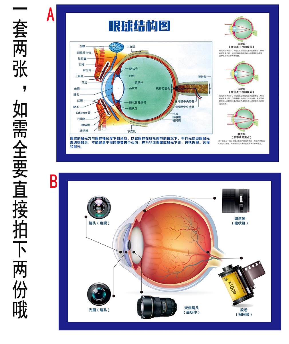 m769眼部结构图眼科眼镜店常识科普挂图266kt展板喷绘海报印制